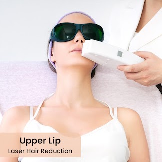 Best Laser Hair Removal Service in Ghaziabad